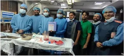चंडीगढ़ पीजीआई में पहली बार पेनम्ब्रा कैट आरएक्स मशीन का इस्तेमाल  हृदय रोगी की जान बचाई